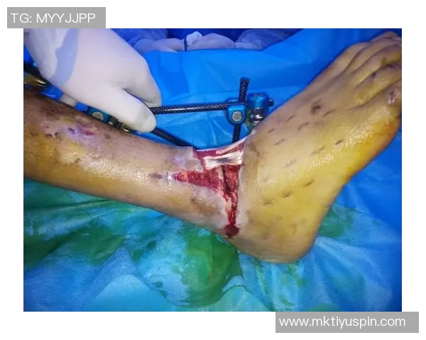 弗兰克谈小卡伤情揭示脚踝问题背后的复杂性与脚部损伤情况